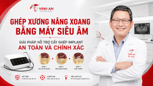 Ghép Xương Nâng Xoang Bằng Máy Siêu Âm