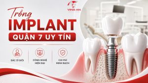 Trồng Implant Quận 7 Uy Tín